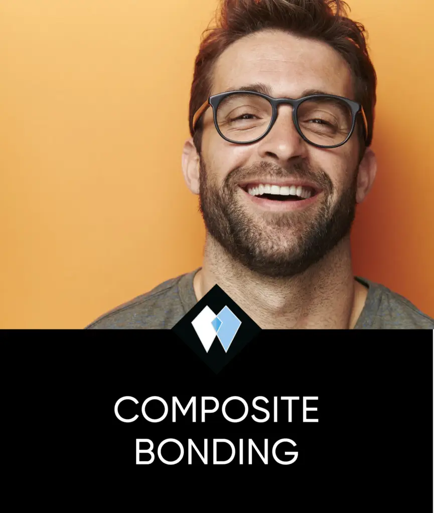 composite bonding thumbnail