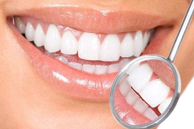 photo of white smile
