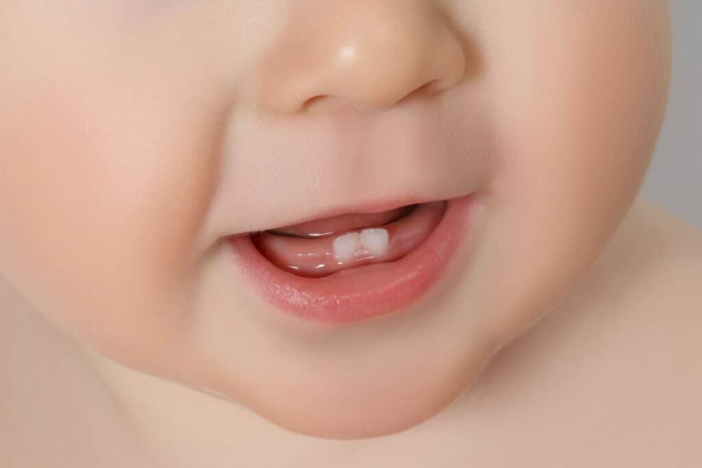 photo of baby with 2 front baby teeth