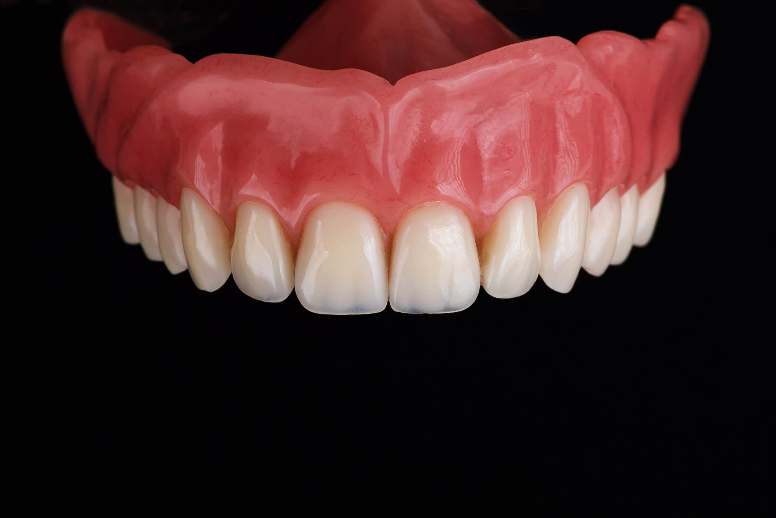 photo of a denture